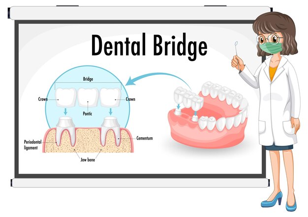 Crowns and Bridges in 2025